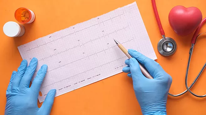 Manos con guantes de latex sobre un electrocardiograma