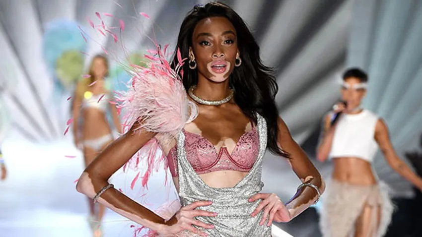 Winnie Harlow, la modelo con vitiligo