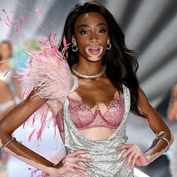 Winnie Harlow, la modelo con vitiligo